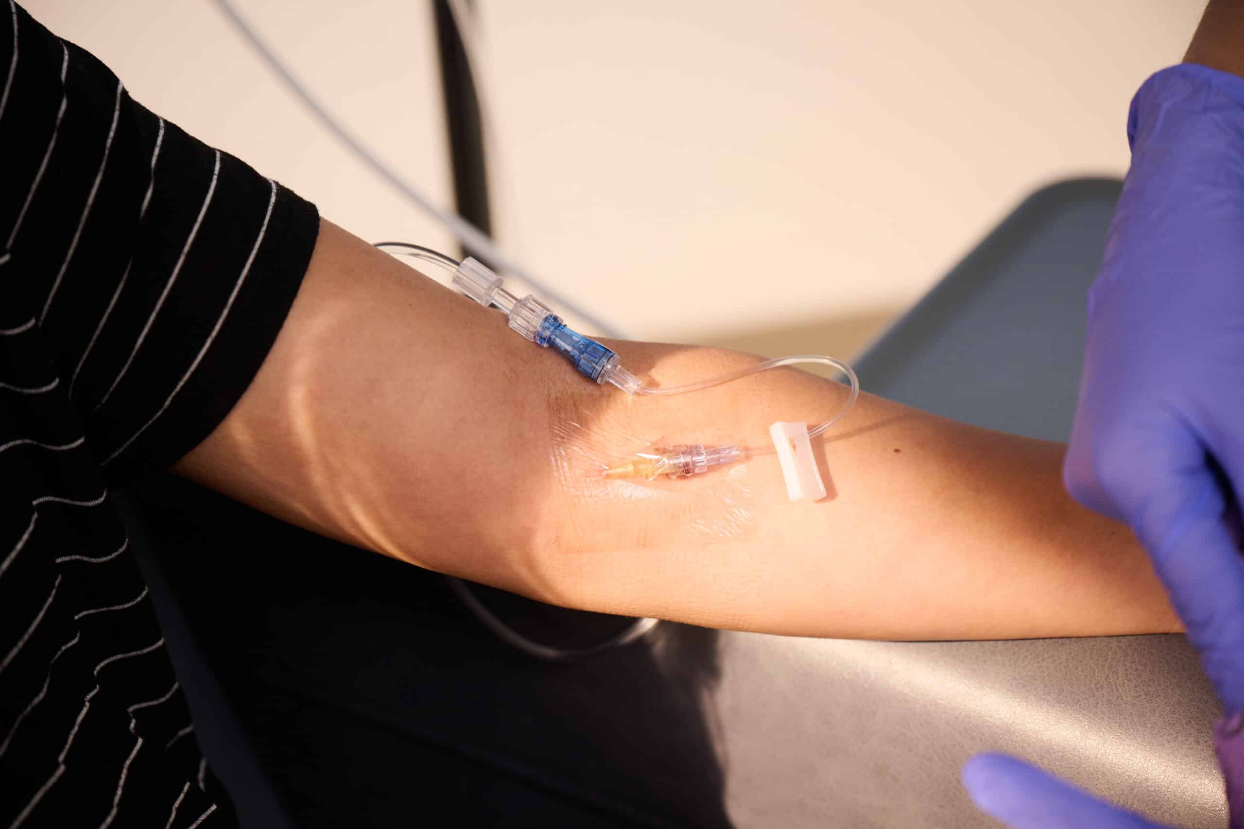 IV