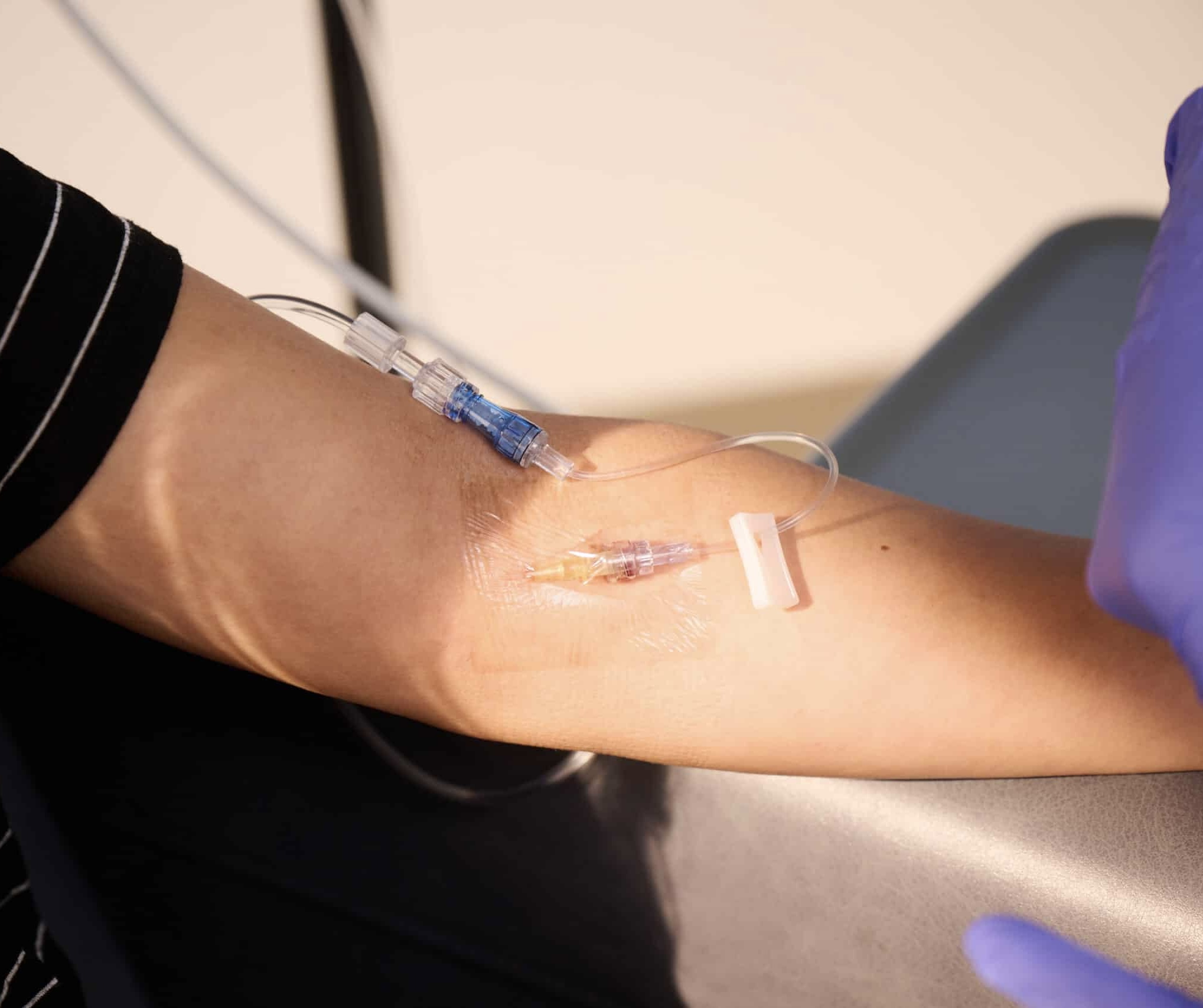 IV